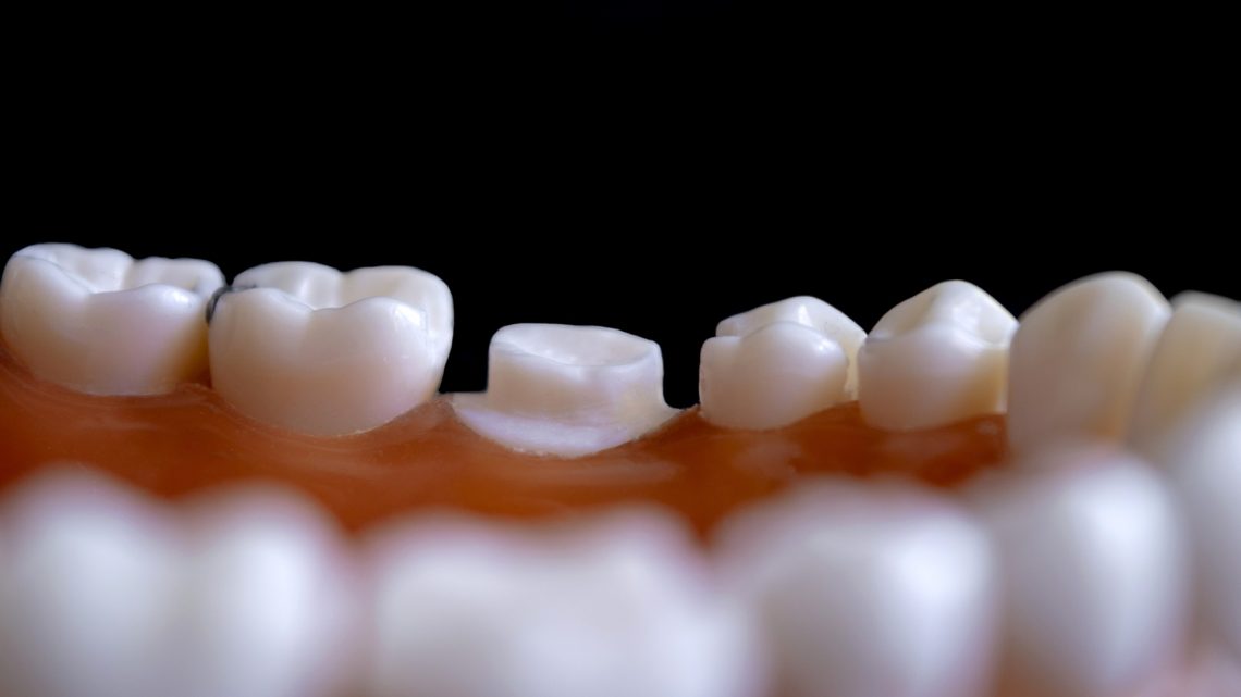 Les 4 aliments qui détruisent vos dents