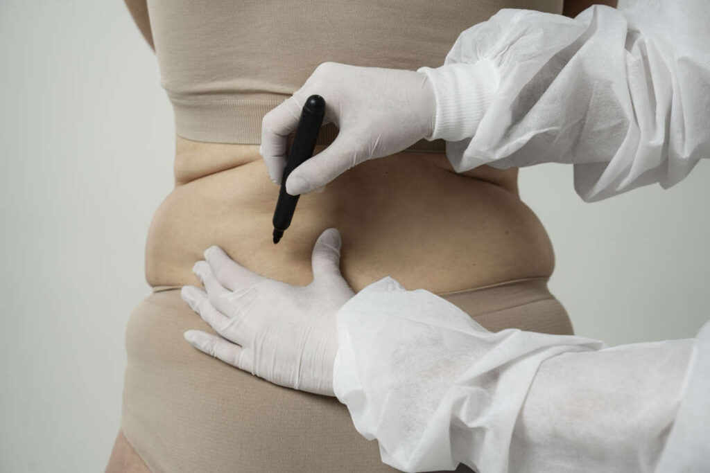 effets-secondaires-possibles-abdominoplastie